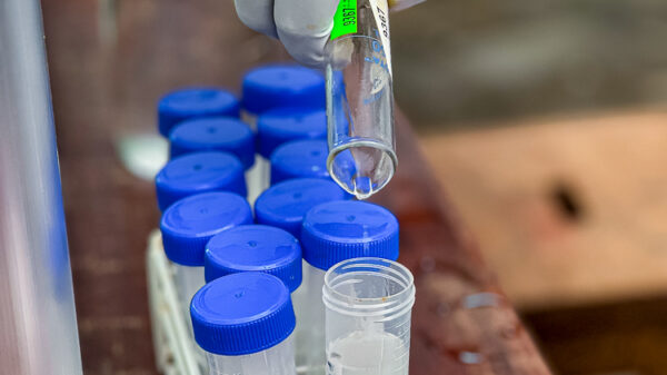 SADC : 9,57 millions $ pour sécuriser la santé en Afrique australe